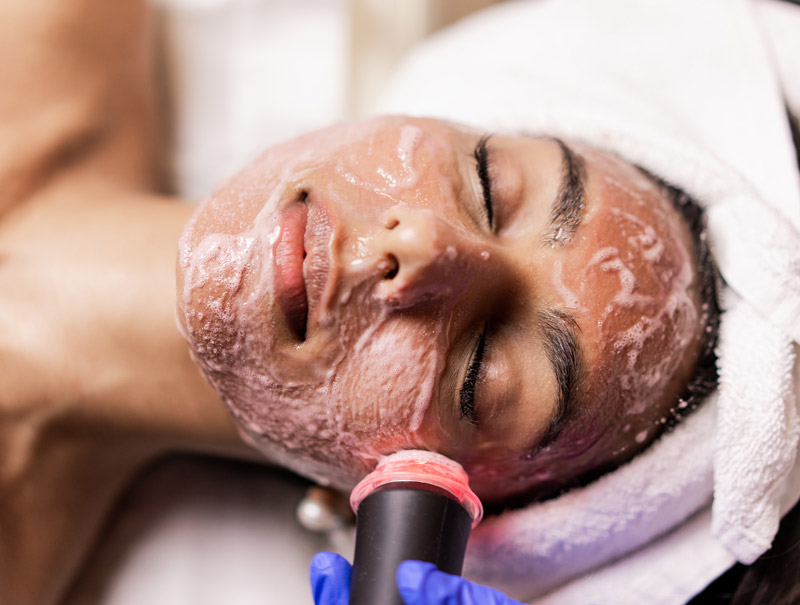 OxyGeneo-Facial at Willow Health and Aesthetics